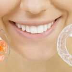 Ортодонтія в стоматології Усмішка: сучасний шлях до рівної усмішки